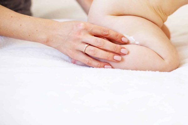 Quels sont les signes de peau sensible chez un bébé ?